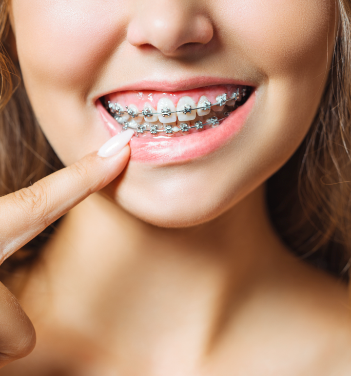 L'appareil
                        multiattaches