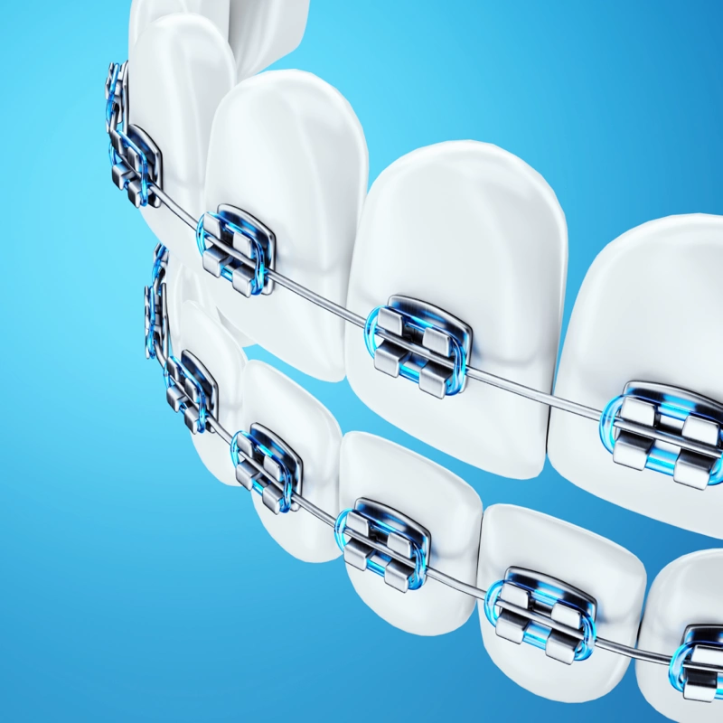 photo appareil dentaire