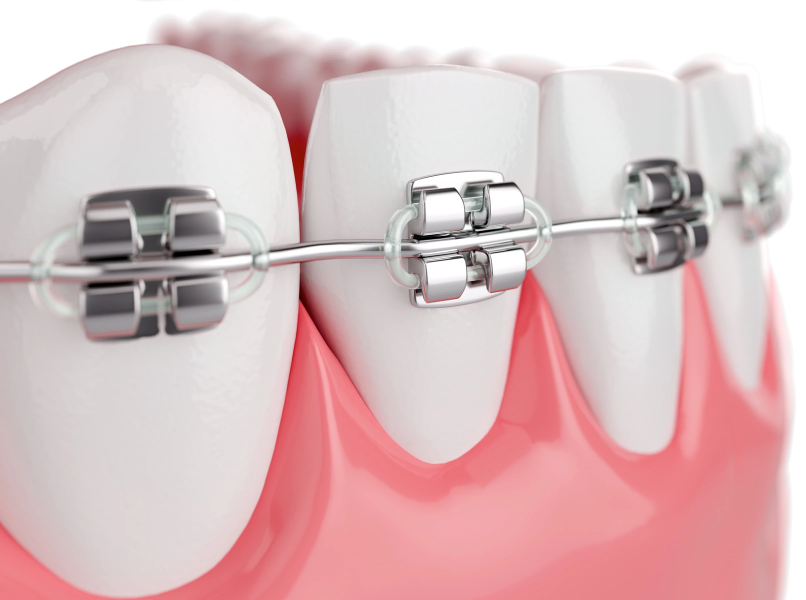 Bagues classiques métalliques et céramiques